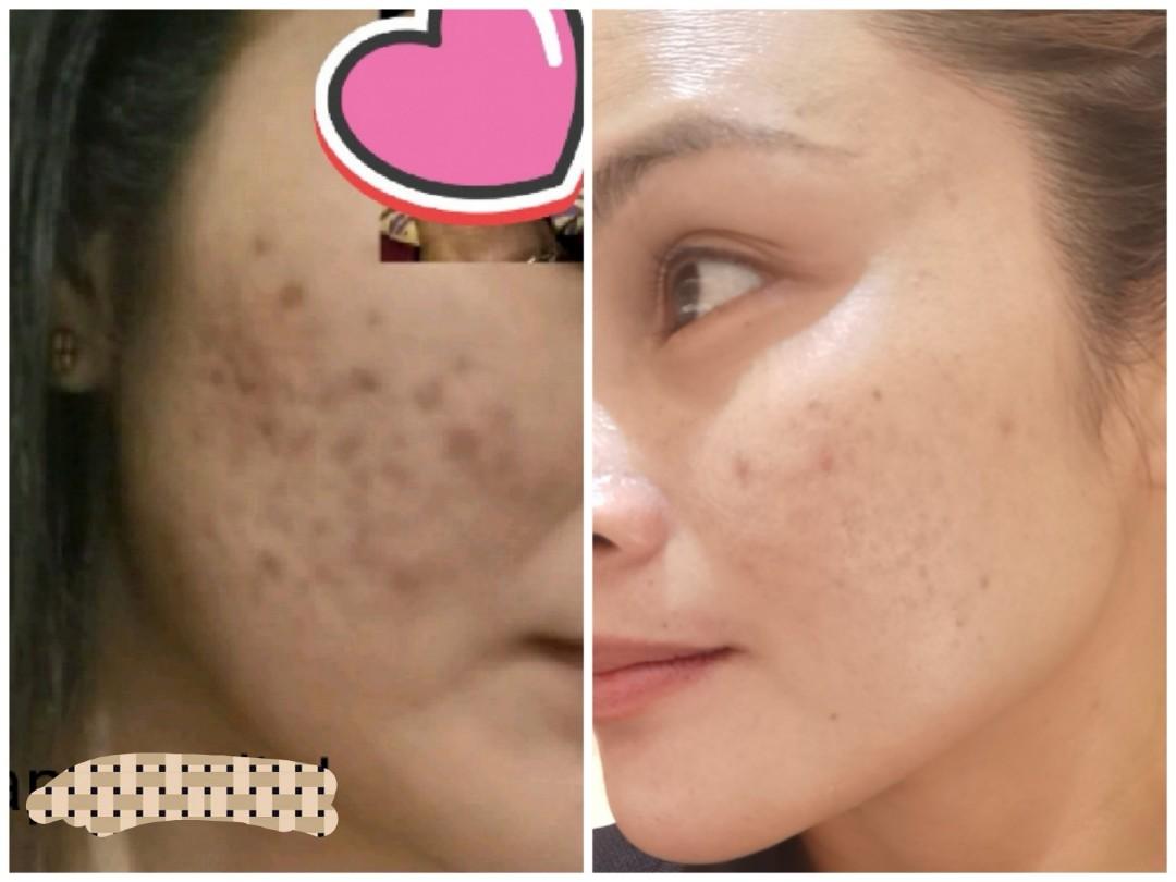 natural health beauty skin