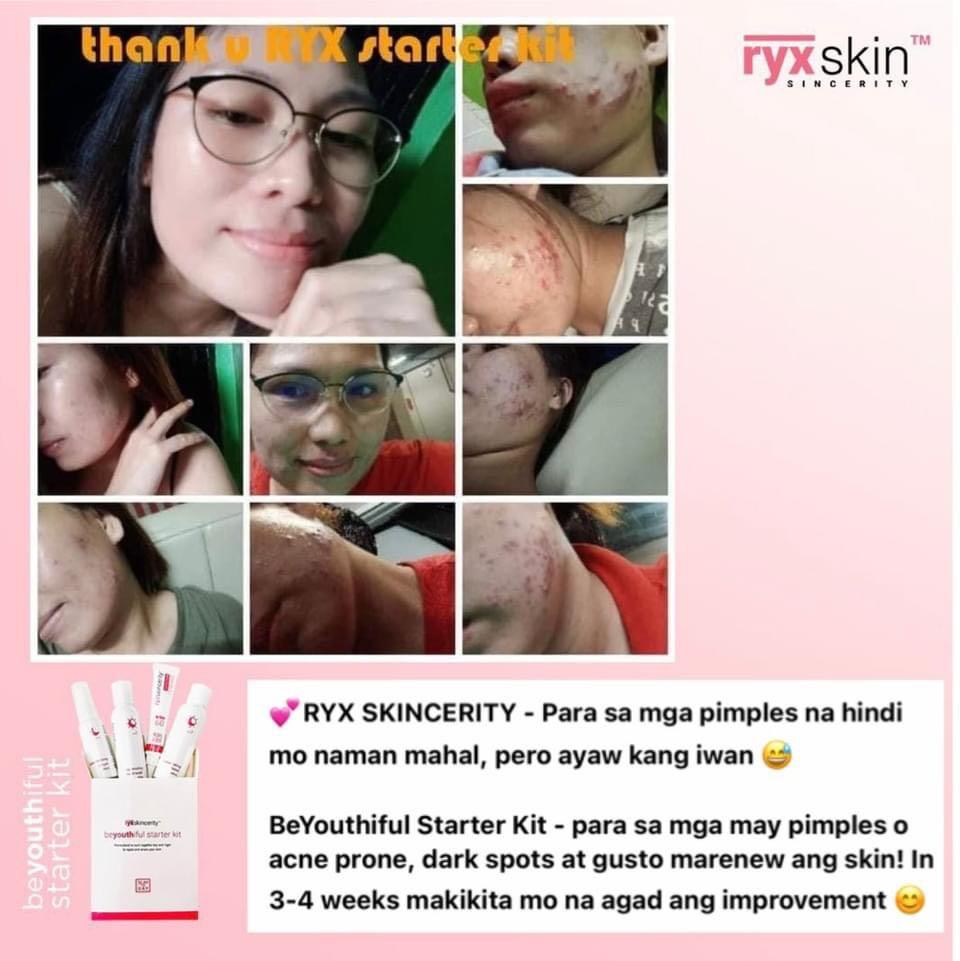 Ryx beYouthiful Starter Kit (Category: Face Care) located in Mandaluyong City. Submitted by charlaloooo (Listing ID 1043570850, Image 3). Description: Mild but wild! 🔥 Beyouthiful Starter Kit's before and after are bombs too, ever since!!! 💣 Check out these slayers lovin' the effect of the Beyouthiful Starter Kit! 💕 #RyxSkin #SlayTheDay #RyxSkincerity #beYOUTHifulStarterKit #RyxStarterKit #RyxSkincerityMandaluyong #Ryx.