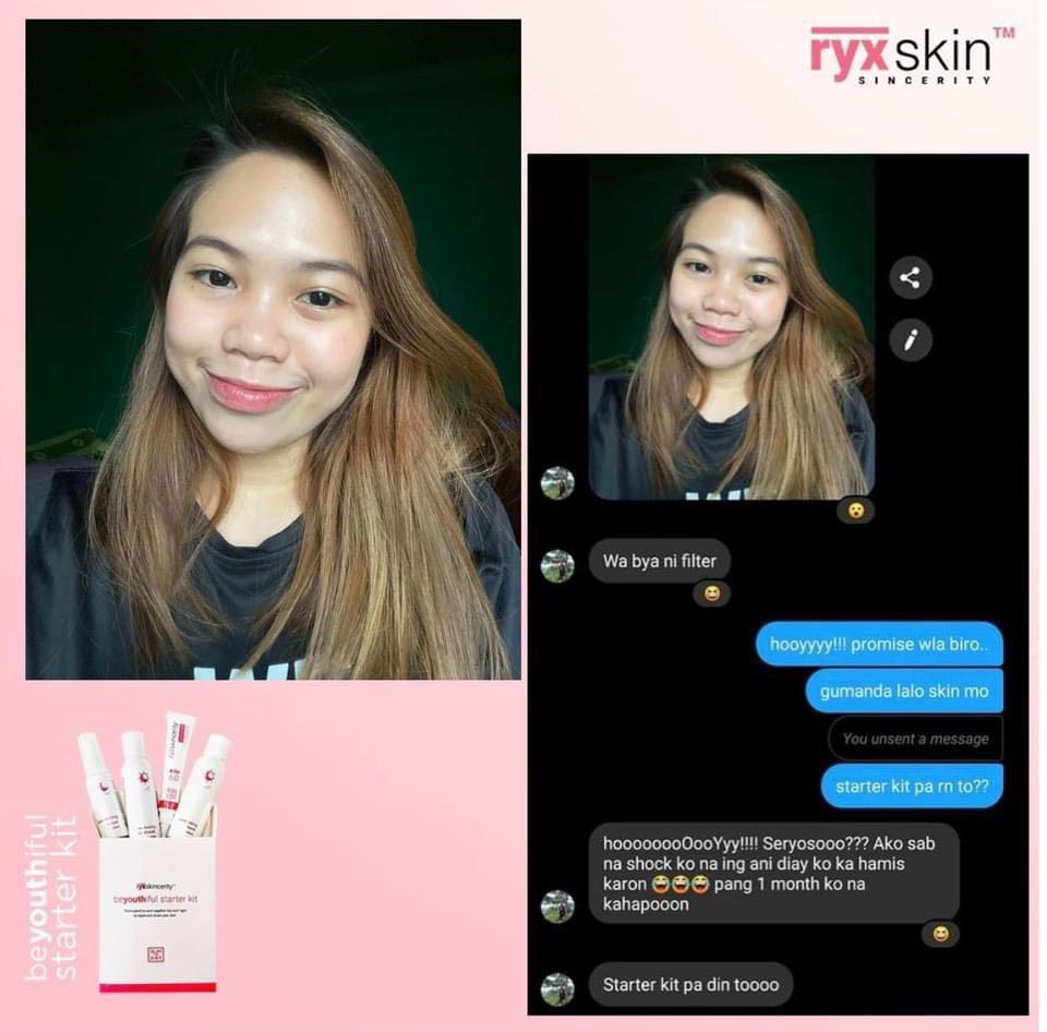 Ryx beYouthiful Starter Kit (Category: Face Care) located in Mandaluyong City. Submitted by charlaloooo (Listing ID 1043570850, Image 2). Description: Mild but wild! 🔥 Beyouthiful Starter Kit's before and after are bombs too, ever since!!! 💣 Check out these slayers lovin' the effect of the Beyouthiful Starter Kit! 💕 #RyxSkin #SlayTheDay #RyxSkincerity #beYOUTHifulStarterKit #RyxStarterKit #RyxSkincerityMandaluyong #Ryx.