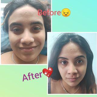 Threading of Brows