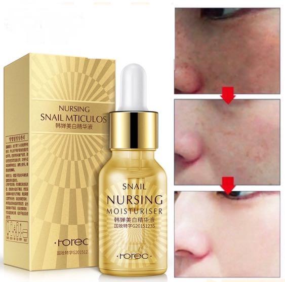 essence acne treatment