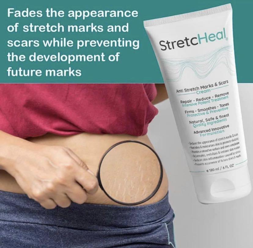 stretcheal before and after