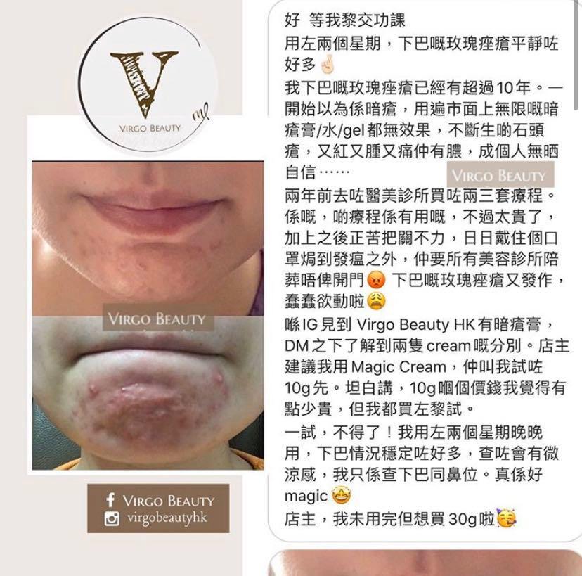 中藥面霜magic Cream 玫瑰痤瘡暗瘡痘印石頭瘡 美容 化妝品 皮膚護理 Carousell