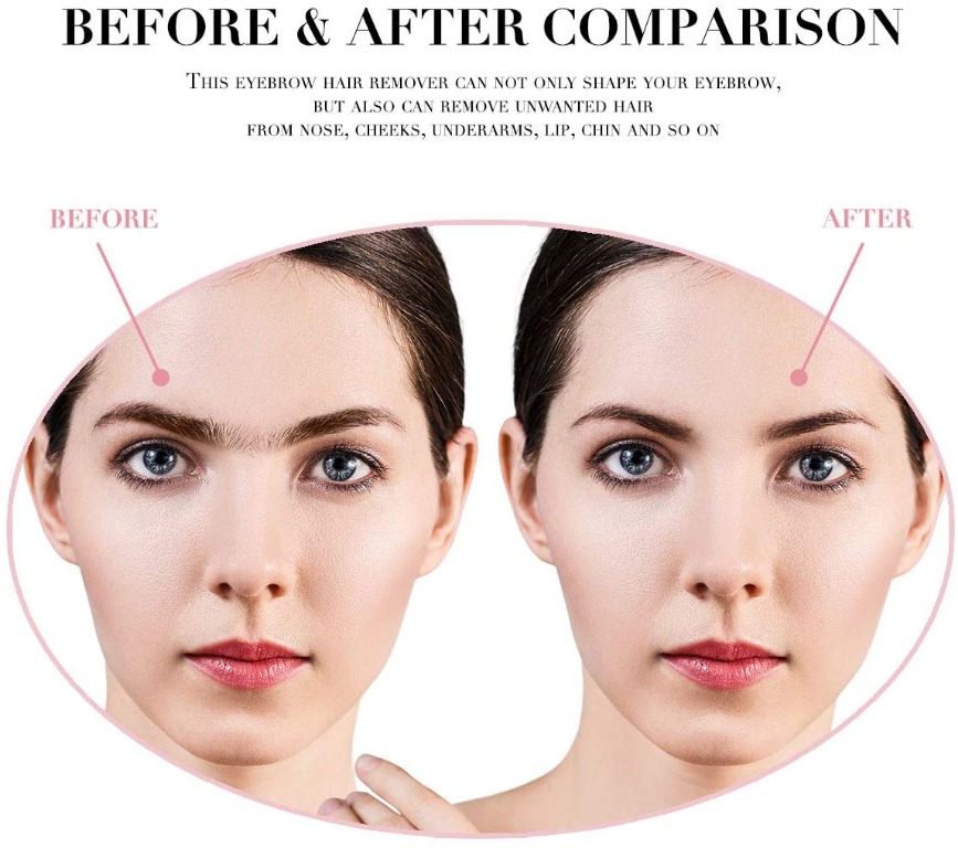 vogcrest hair remover