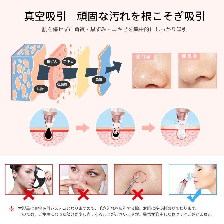 日本直送anlan 毛穴吸引器男女合用 美容 化妝品 皮膚護理 Carousell