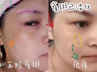 (Category: ) located in . Submitted by yyuyuu (Listing ID 1056229253, Image 1). Description: .