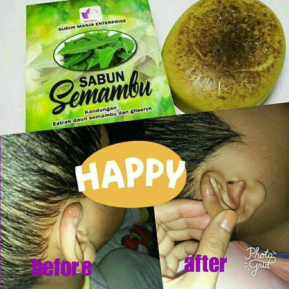 Semambu (Category: Health Food, Drinks & Tonics) located in Singapore. Submitted by lay-la (Listing ID 1053895342, Image 3). Description: Hello my awesome mummies& daddies!!! . . ◾ SUSUK MANJA ENT: SEMAMBU SET. . . don't worry. We sell individual items too. ◾semambu soap ◾semambu balm ◾semambu lotion. no worries , you can try 1 at a time but would recommend all 3 because each one of them have their benefits. . . takper kalau masih ragu2, DM saya 