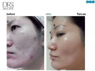 (Kategori: ) berada di . Dikirim oleh bbkkccsg (ID iklan 1054371685, Gambar 1). Deskripsi: .