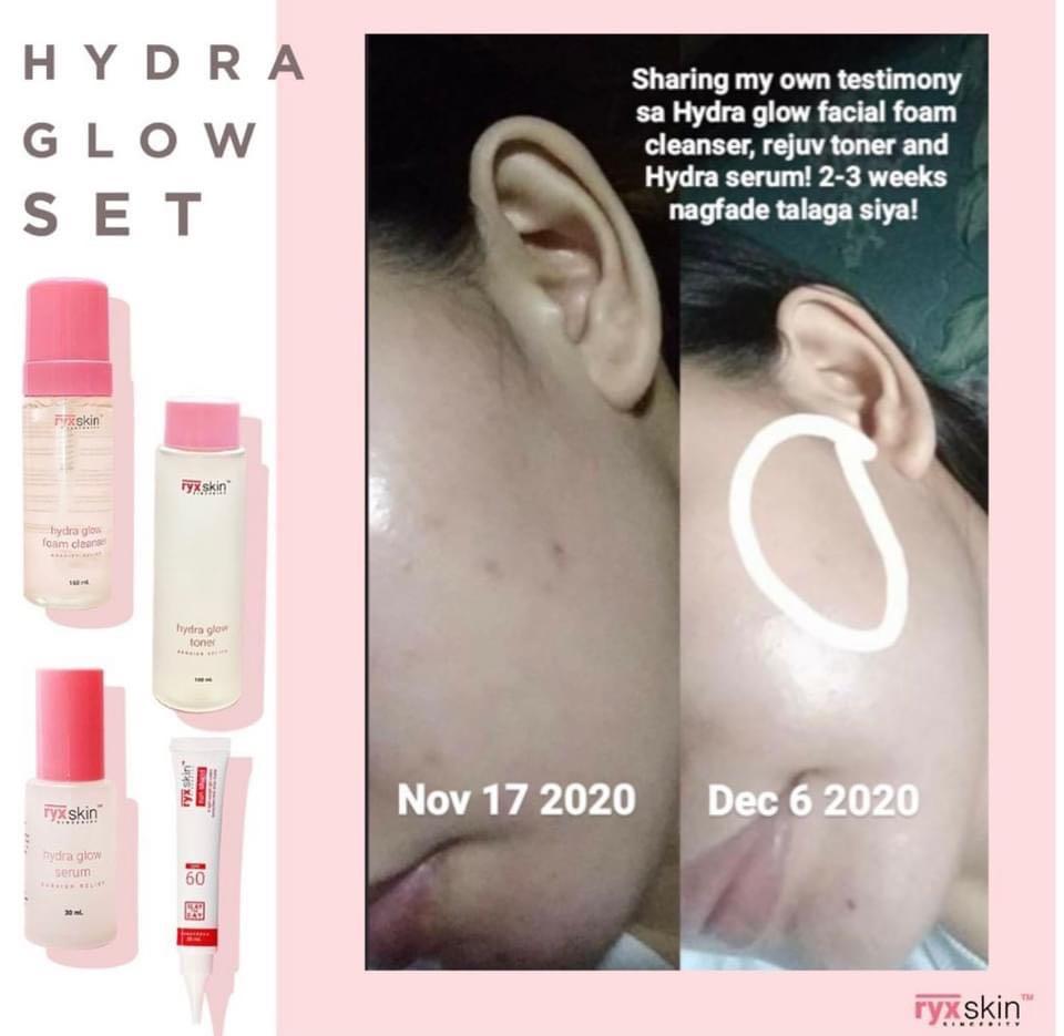 RYX Hydra Glow Set (Category: Face Care) located in Mandaluyong City. Submitted by charlaloooo (Listing ID 1054604904, Image 3). Description: RYX SKIN HYDRA GLOW SET ✨ Your. Mildest. Skincare. Ever! Made with quality ingredients! Its main purpose is to lock some hydration on your skin ❤️ Chok-chok skin, as referred by the Koreans💦✨ #RyxSkinSincerity #RyxHydraGlowSet #RyxSkincerity #RyxSkin #RyxSkincerityMandaluyong .