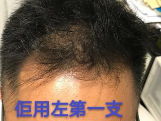 （分類：）位於 。 由 goal2shop 提交（商品編號 1005558888，圖片 1）。簡介： 。