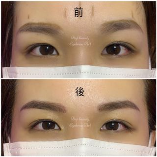 #洗眉#洗紋身#霧眉 #飄眉 #隱型眼線 #粉霧唇 #髮際線 #美睫角蛋白 #去油脂粒 #去癦 #去疣#打斑#水光#面部護理 Collection item 2