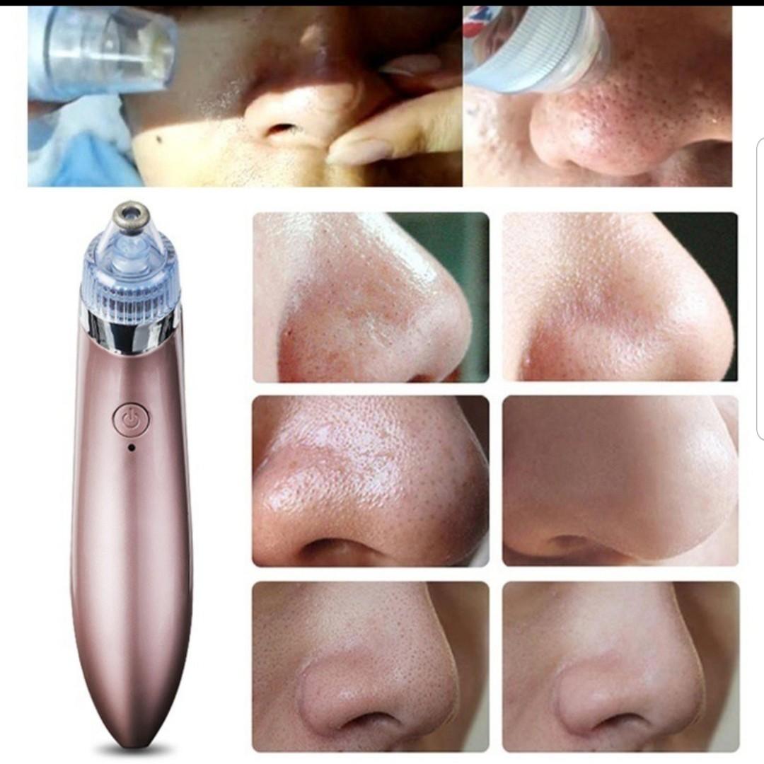 electric cleanser for blackheads