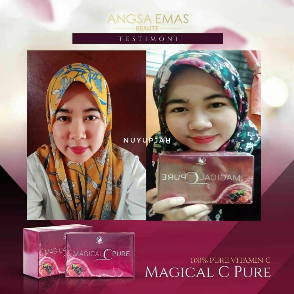 Magical C Pure Beauty Personal Care Face Face Care On Carousell