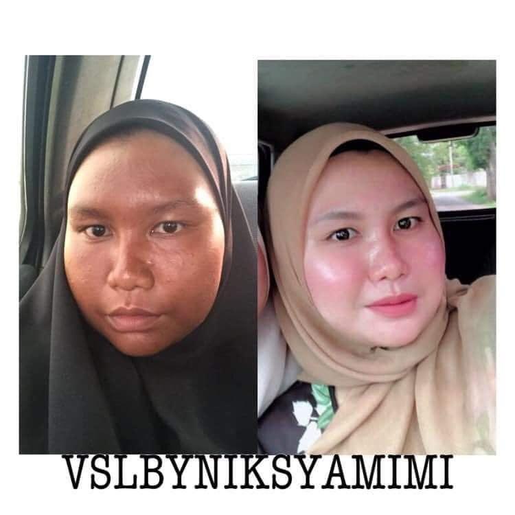 Vsl Skincare Beauty Personal Care Face Face Care On Carousell