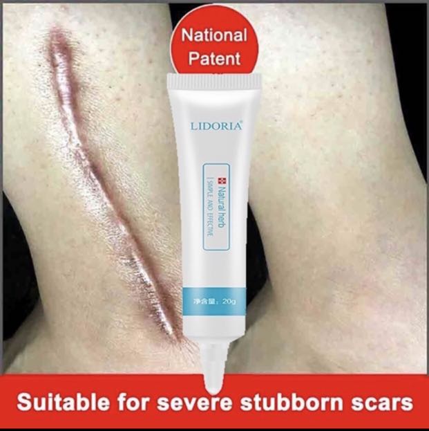 lidoria acne cream