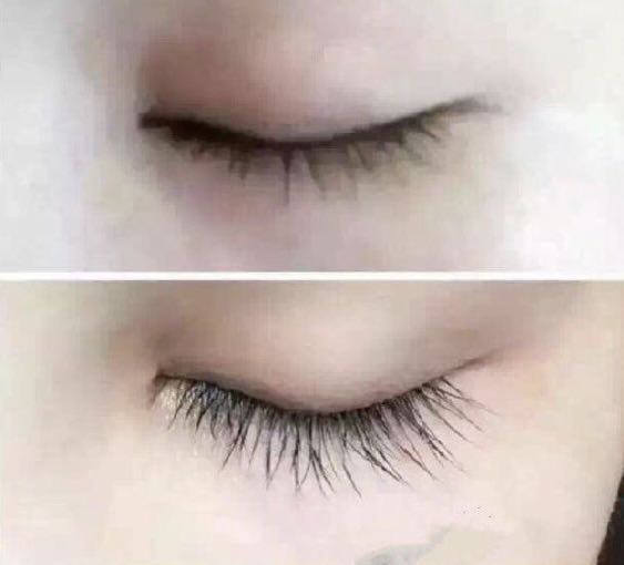 eyelash regrowth