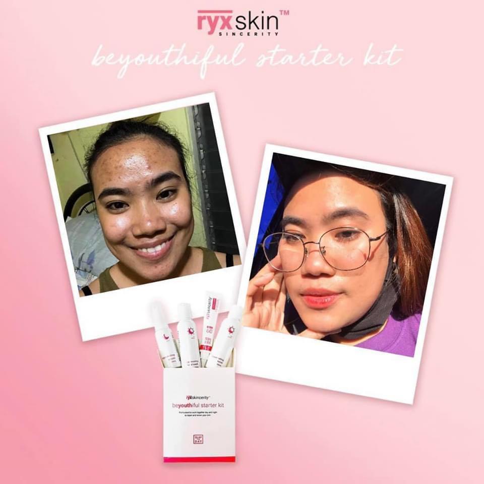 Ryx Skincerity beYouthiful Starter Kit (Category: Face Care) located in Mandaluyong City. Submitted by charlaloooo (Listing ID 1014276014, Image 1). Description: Miss niyo na? 😍 Available na po ulit! Limited stocks only❤️ #RyxSkin #BeYouthifulStarterKit #NotYourOrdinaryRejuvenatingSet #RyxRejuvenatingSet #RyxSkincerityMandaluyong.