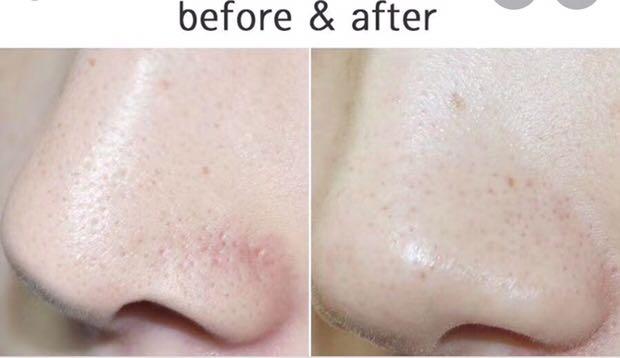 dr sensitive pore tightening serum
