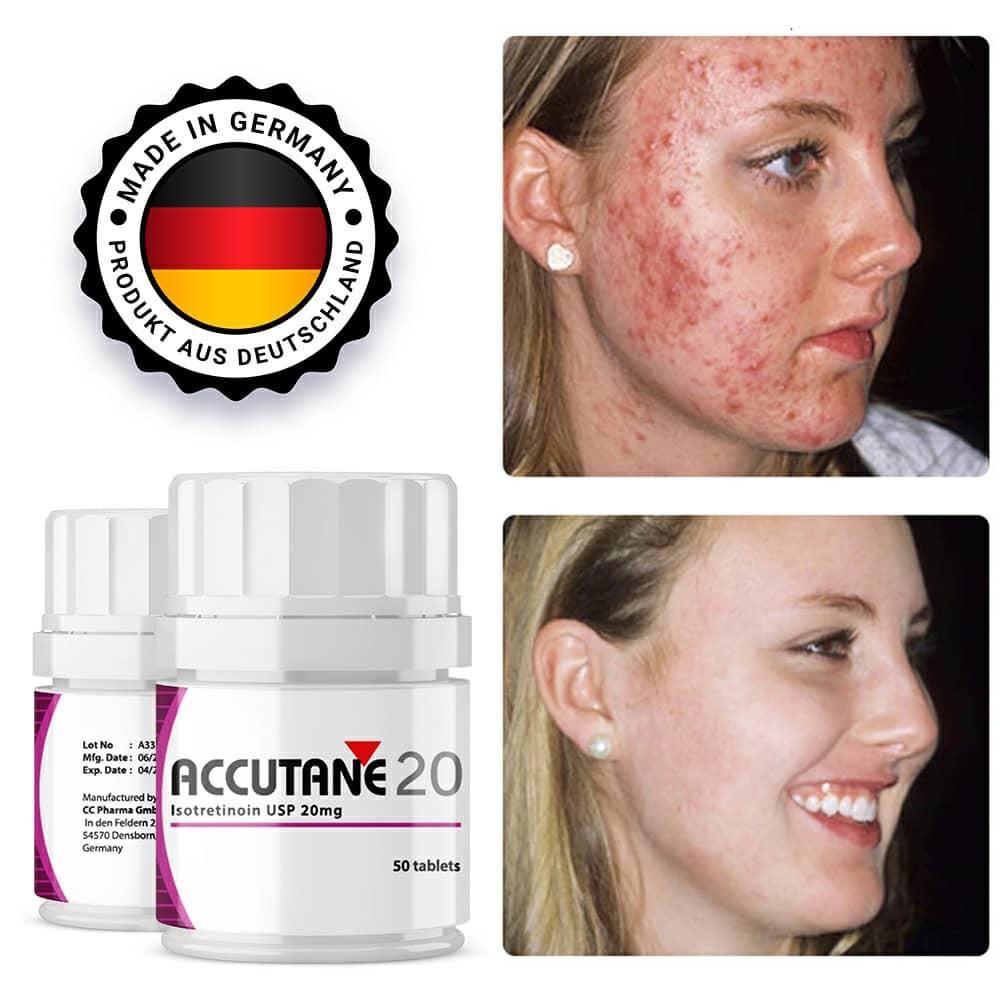 Accutane — Preise über das Internet