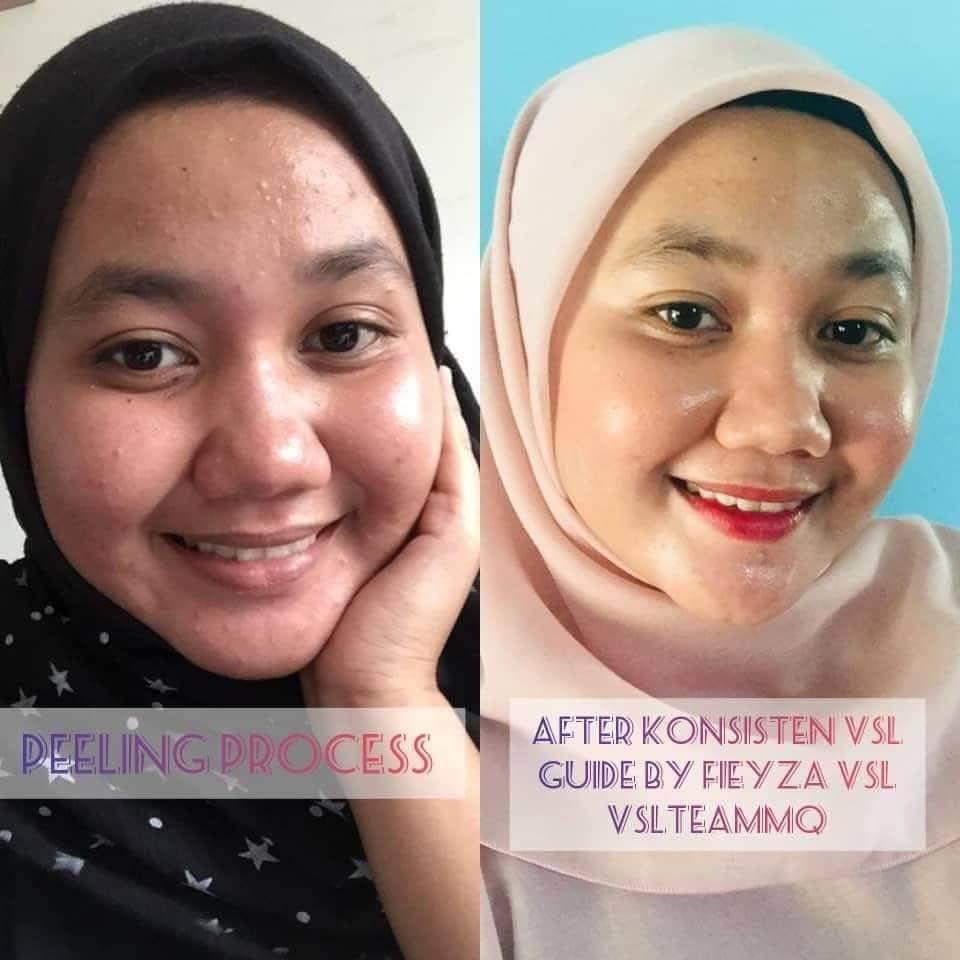 Vsl Skincare Carousell