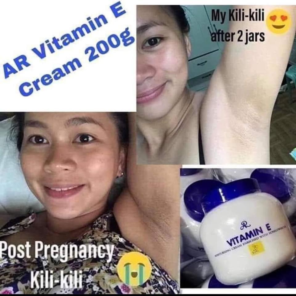 before and after vitamin e cream