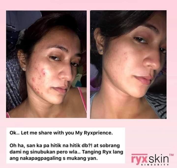RYX Starter Kit (Rejuvenating) (Category: Face Care) located in Manila. Submitted by thesmartchic.ph (Listing ID 1019764729, Image 2). Description: ✔️ Legit reseller of Ryx products..