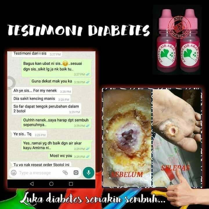 Air Akar Kayu Amirna Health Beauty Hand Foot Care On Carousell