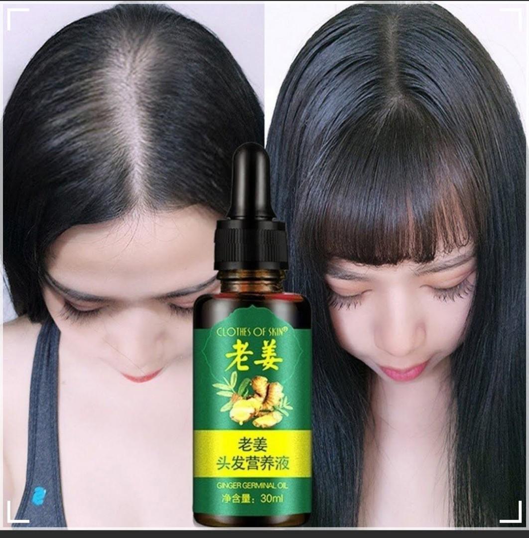 CAN TRY Hair Loss Treatment Ginger Hair Growth Oil, Beauty Personal Care,  Hair On Carousell | 10ml Hair Growth Serum For Hair Loss And Hair Regrowth  Ginger Hair Growth Oil For Thinning/balding /