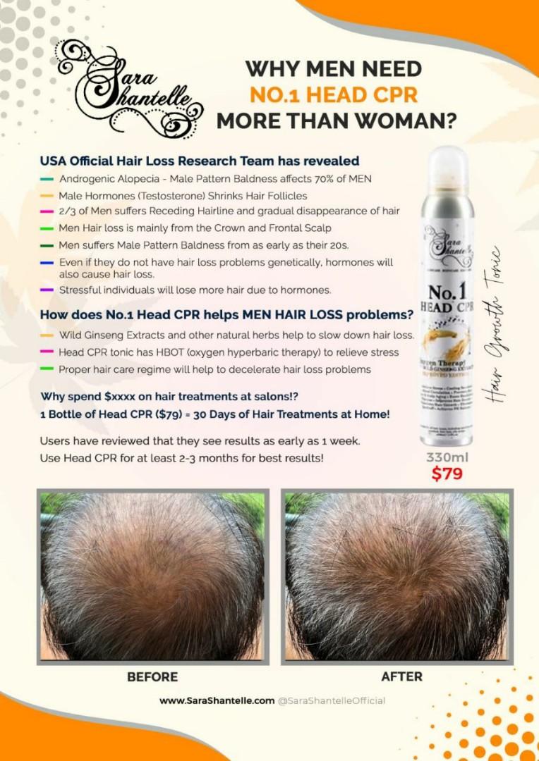 NO.1 Head Cpr Hair Treatment, Beauty & Personal Care, Hair on Carousell