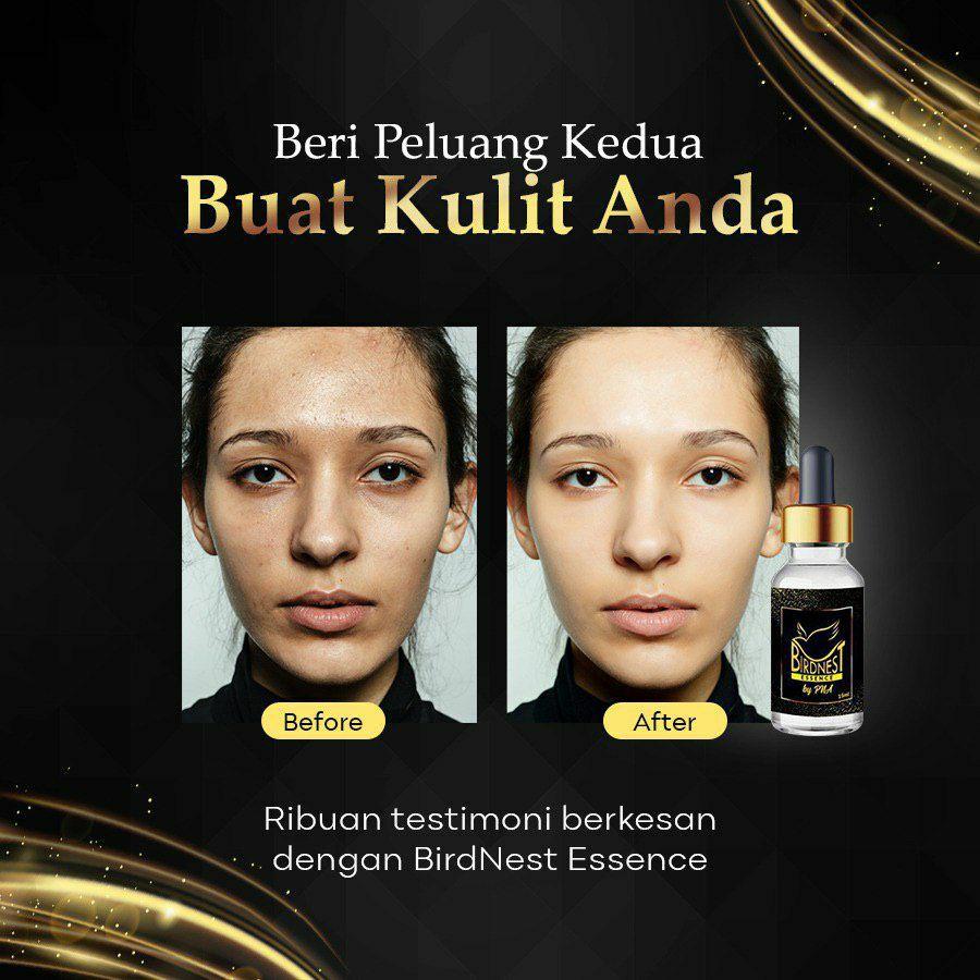 SERUM BNE / BIRD NEST ESSENCE SERUM / ACNE / JERAWAT, Health & Beauty