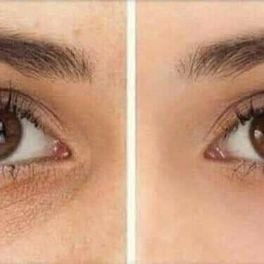 Beau Yeux Under Eye Cream Health Beauty Face Skin Care On Carousell