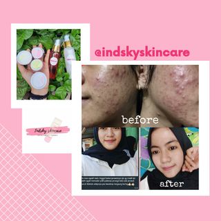 (Kategori: ) berada di . Dikirim oleh indahsgr (ID iklan 1017851788, Gambar 1). Deskripsi: .