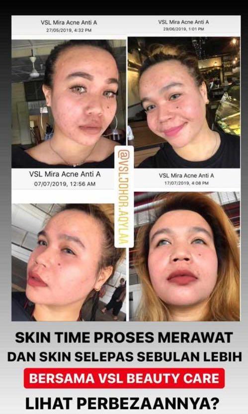 Vsl Skincare Health Beauty Face Skin Care On Carousell