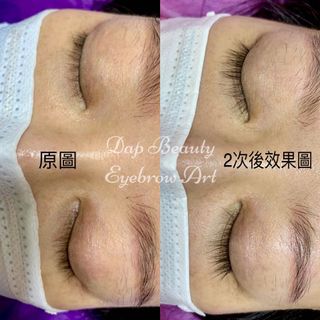 #洗眉#洗紋身#霧眉 #飄眉 #隱型眼線 #粉霧唇 #髮際線 #美睫角蛋白 #去油脂粒 #去癦 #去疣#打斑#水光#面部護理 Collection item 1