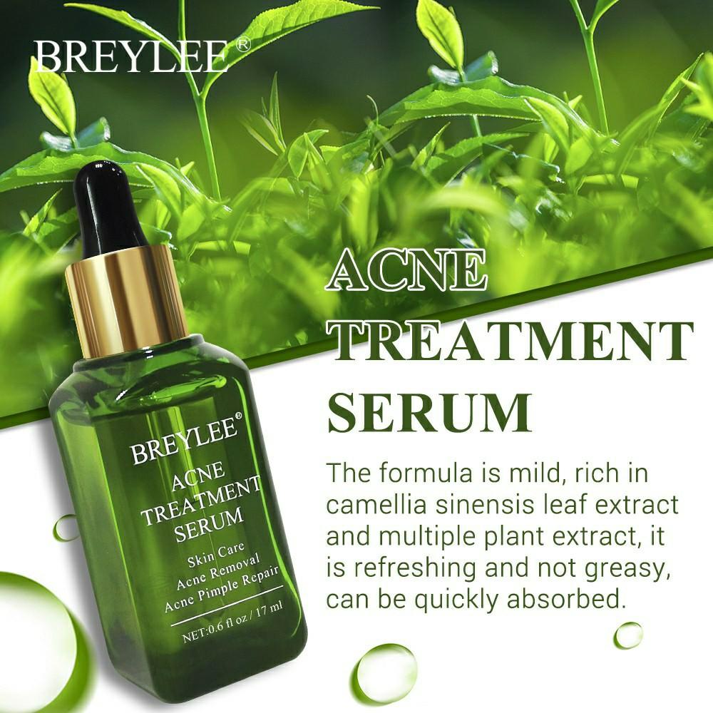 breylee acne treatment serum