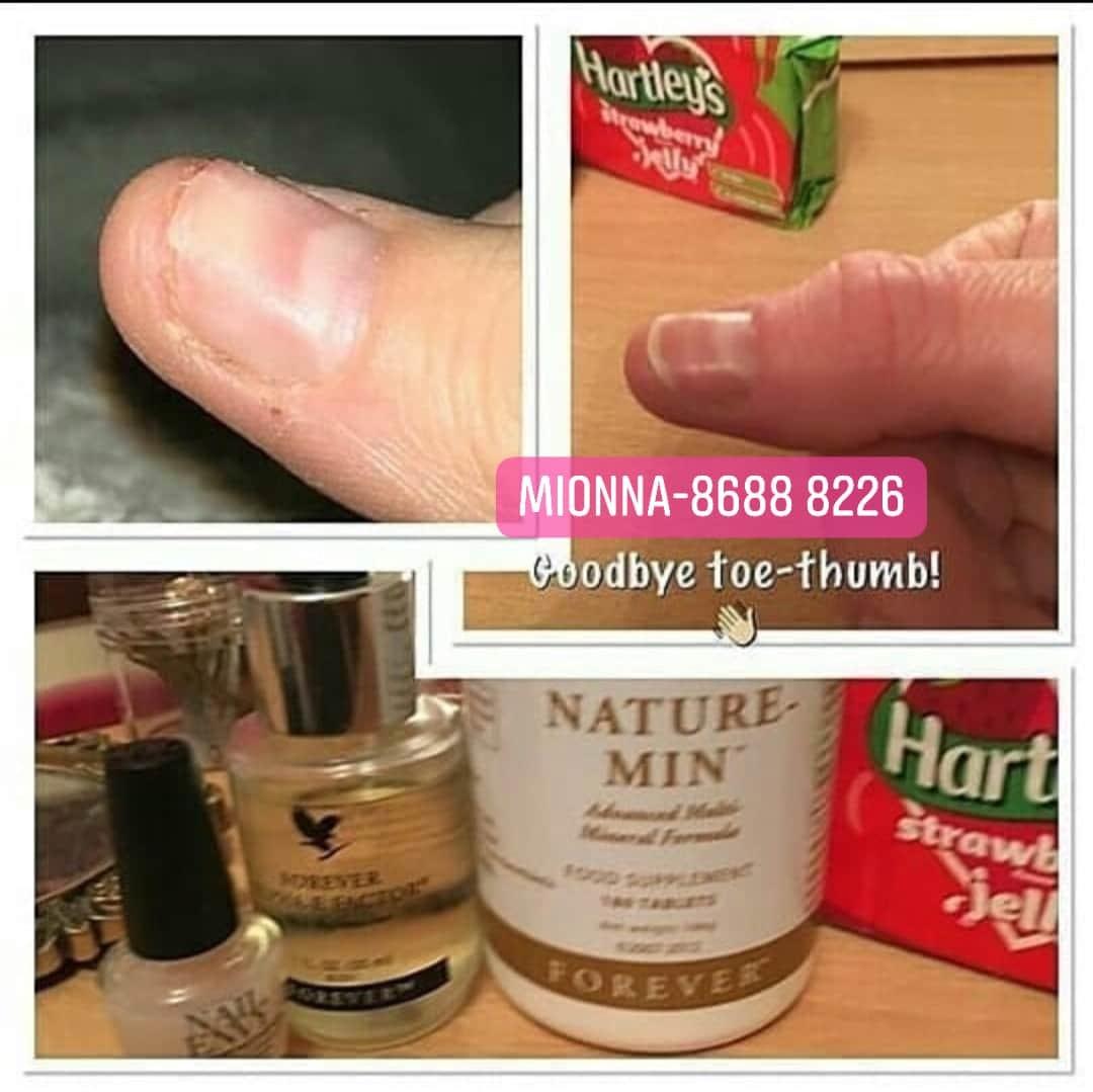 Alpha E Factor (Antiaging) (Category: Face Care) located in Singapore. Submitted by mionna (Listing ID 1022672016, Image 4). Description: Looking for #VitaminE? Here’s something that is very good for #DrySkin, #CuticleCare and #StretchMarks!! 😃 Note: Apply it on your necks to hide your age. 🤭 Alpha-E Factor® 🎭 Nourishes and restores hydration 🎭 Supports elasticity and helps prevent premature signs of aging 🎭 Anti-pollution power vitamin E 🎭