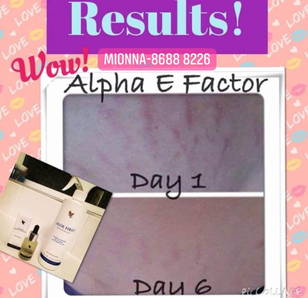 Alpha E Factor (Antiaging) (Category: Face Care) located in Singapore. Submitted by mionna (Listing ID 1022672016, Image 3). Description: Looking for #VitaminE? Here’s something that is very good for #DrySkin, #CuticleCare and #StretchMarks!! 😃 Note: Apply it on your necks to hide your age. 🤭 Alpha-E Factor® 🎭 Nourishes and restores hydration 🎭 Supports elasticity and helps prevent premature signs of aging 🎭 Anti-pollution power vitamin E 🎭