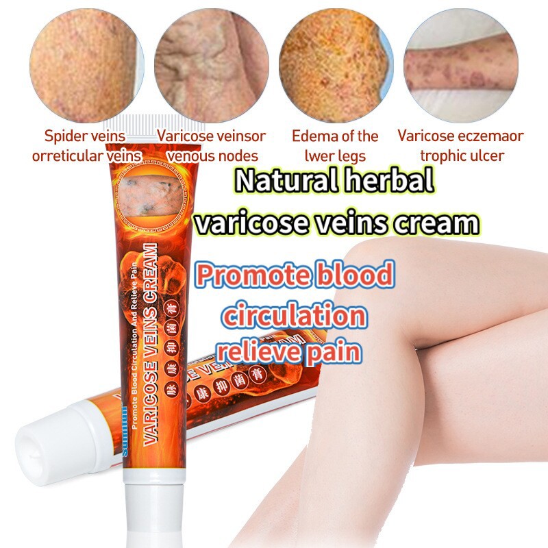 hirudoid cream for rosacea