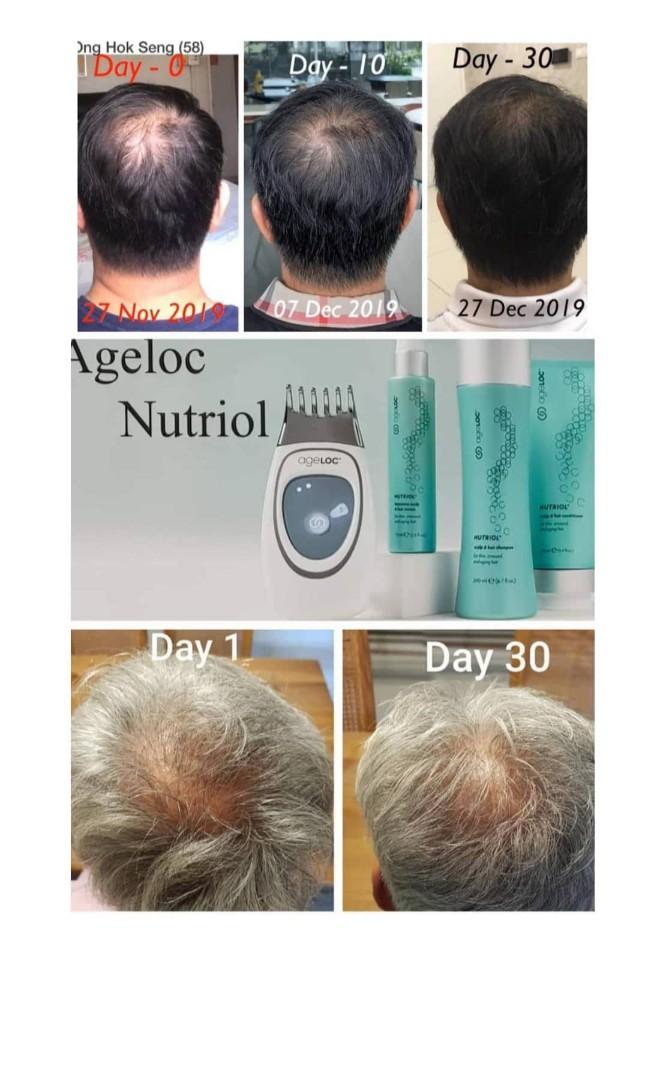 ageLoc Nutriol Scalp system (Category: Hair) located in Singapore. Submitted by home_based_biz (Listing ID 1018176541, Image 2). Description: Meet the new ageLOC Nutriol Scalp & Hair system ! See my result ! Be the product of the product 😘 Preview in Nov, limited sets! If you like to know more how can you be part of this US79Bil market, let's chat !.
