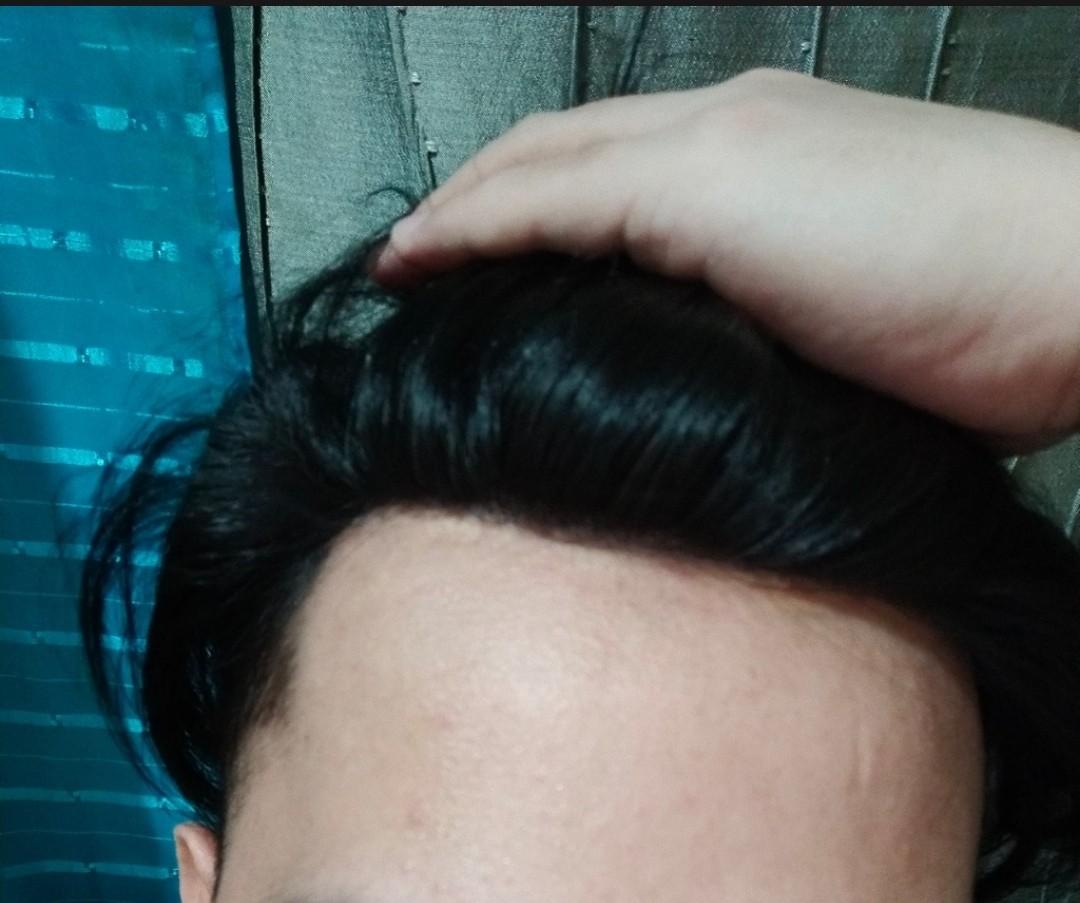 human hair wig topper (Category: Hair) located in Manila. Submitted by wadeandrei (Listing ID 1025241626, Image 2). Description: human hair wig topper wig instant hair best gift to your daddy 😍Gawin muli ang iyong buhok at nakaraan na istilo 💖High-Quality💖Heat Resistant💖Breathable 😎Way hugasan at alagaan Mag-click upang bumili 👉 pm is the key topper hair wig human hair wig.