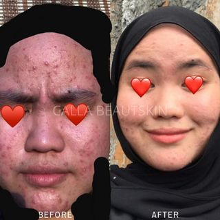 (Category: ) located in . Submitted by rainbowdustsg (Listing ID 1027511957, Image 1). Description: .