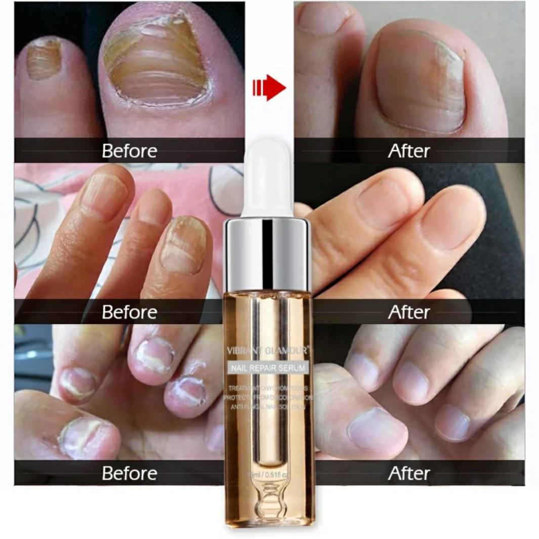 Vibrant Glamour Nail Repair Serum, Beauty & Personal Care, Face, Face Care on Carousell
