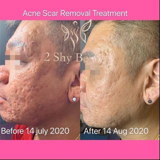 Face Treatment Collection item 2