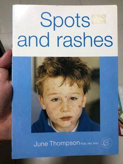 Spots and Rashes by June Thompson