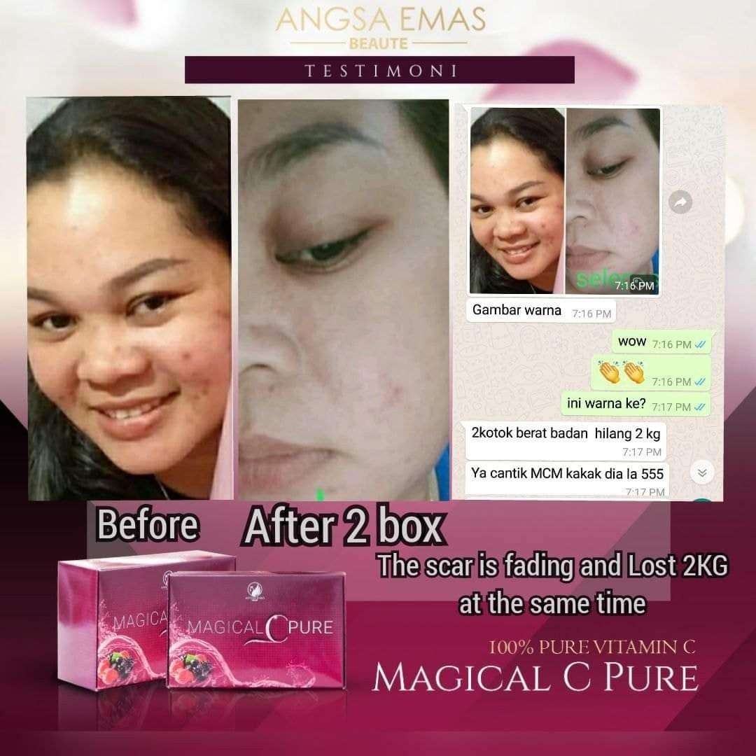Jamu Mcp Magical C Pure Vitamin C Health Nutrition Health Supplements Vitamins Supplements On Carousell