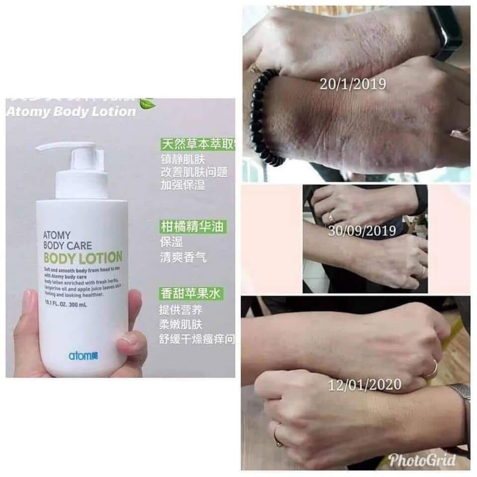 Atomy Body Lotion Beauty Personal Care Bath Body Body Care On Carousell
