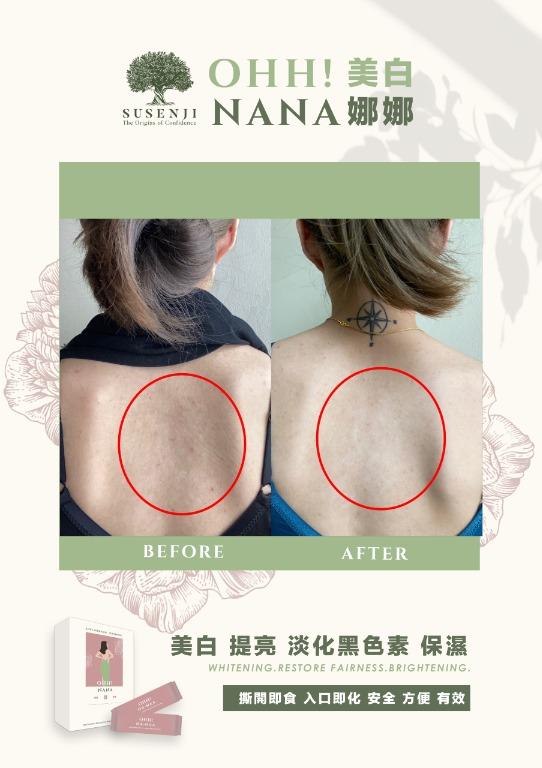 Susenji Nana Whitening Beauty Oral Supplement for whitening, glowing