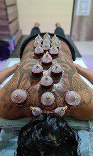 Bekam/ cupping therapy