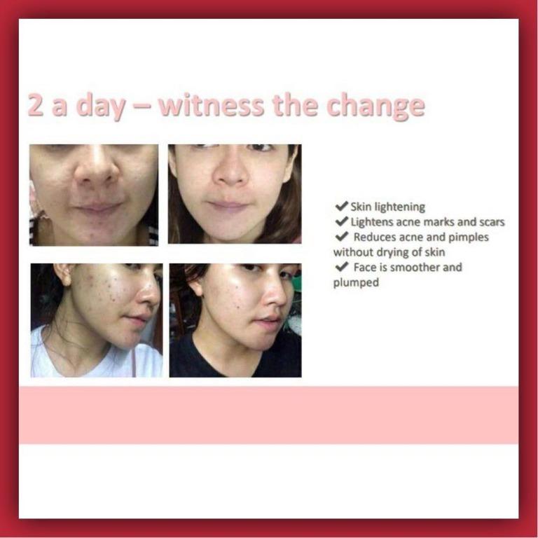 [AUTHENTIC] Eight Karats Eighteen Vitaskin Nutricosmetic Beauty