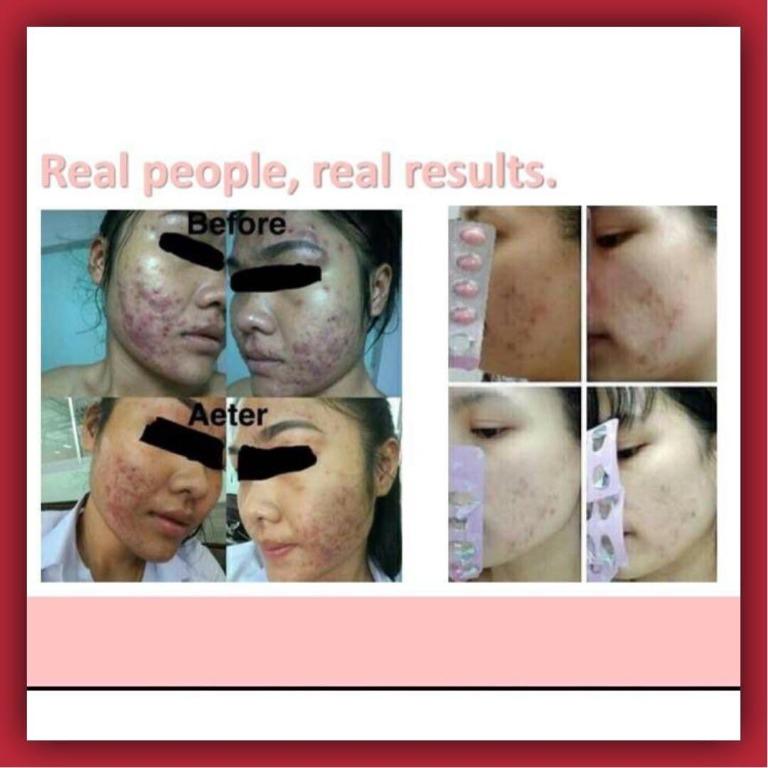 [AUTHENTIC] Eight Karats Eighteen Vitaskin Nutricosmetic Beauty